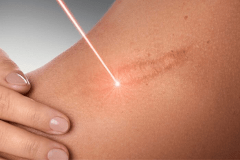 EPImed Lasers - Μηχανήματα Αισθητικής - Ιατρικές Συσκευές